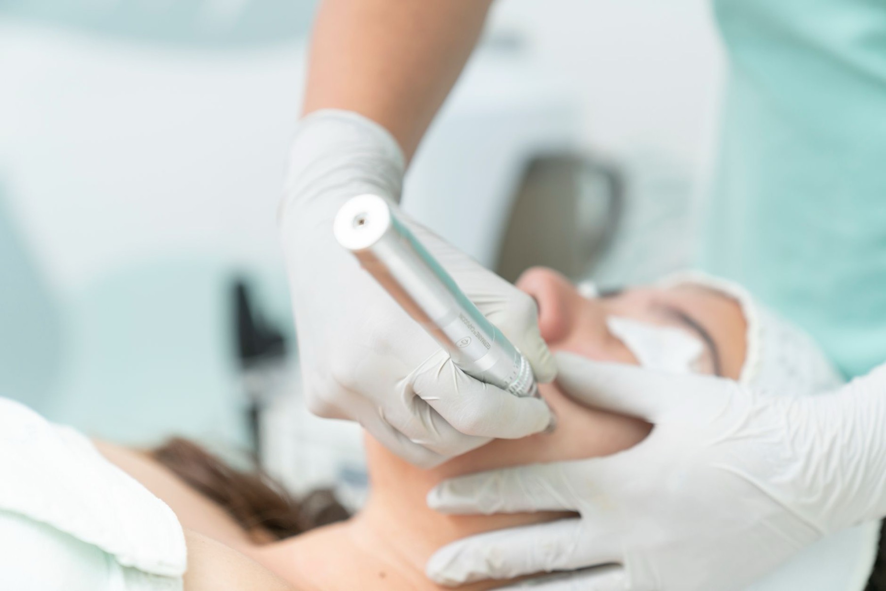 Microneedling
